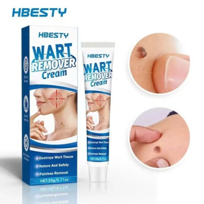 Kem Trị Mụn Cóc, Mụn Thịt, Mụn Cơm Hiệu Quả Sau 7 Ngày – Chiết Xuất Thảo Dược An Toàn 20g