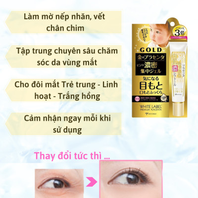 [DƯỠNG TRẮNG TOÀN DIỆN] Combo Bộ Sản Phẩm Dưỡng Da Cao Cấp Nhau Thai Nhật Bản MICCOSMO White Label Gold (Nước Hoa Hồng, Gel Tẩy Trang, Kem Dưỡng, Kem Mắt - CB09)