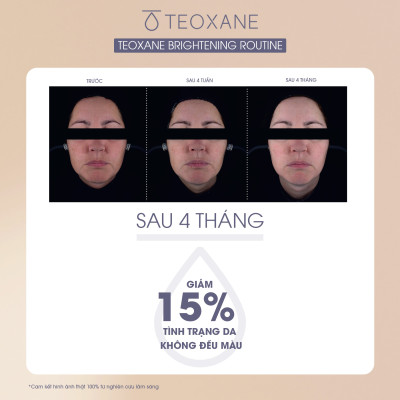 Serum làm sáng và săn chắc da RHA VIT C SERUM