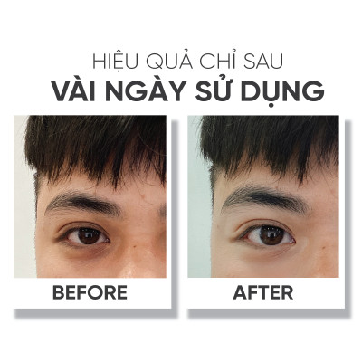 Kem dưỡng vùng da quanh mắt Lá House Recovery Eye Cream 15ml