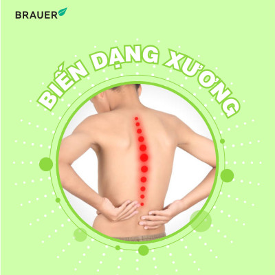 Vitamin D3 cho trẻ sơ sinh, trẻ nhỏ và người lớn Brauer Úc giúp trẻ phát triển chiều cao, phòng loãng xương, ngủ ngon, tăng sức đề kháng-OZ Slim Store