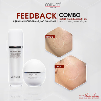 Kem dưỡng trắng da, mờ nám & tàn nhang Mirum 55ml– Mirum Glow Synergy Cream