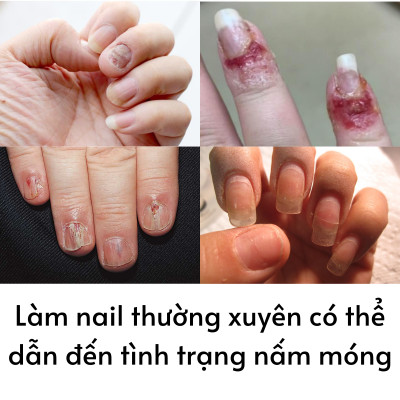 Set 20 Miếng Dán Móng Tay Silicon Nghệ Thuật Nhập Khẩu Hàn Quốc Bellaeve