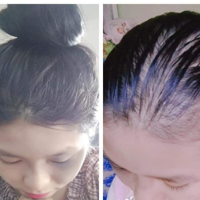 COMBO 2 CHAI TINH CHẤT GỘI ĐẦU THẢO MỘC MẸ KEN-MỖI CHAI 500ml