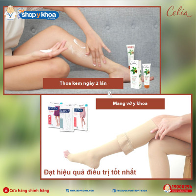 [DATE 12.2027] Kem Thoa Giãn Tĩnh Mạch Chân Celia - dung tích 100ml